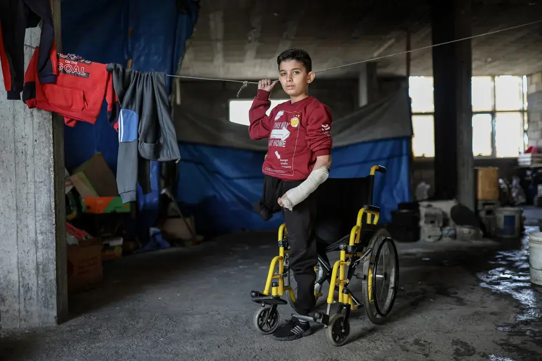 Mohammed al-Mubayyid, ni&ntilde;o de 12 a&ntilde;os, que perdi&oacute; una pierna en un ataque perpetrado por el ej&eacute;rcito terrorista israel&iacute; contra el barrio de al-Zaytoun, en la ciudad de Gaza, es fotografiado el 3 de diciembre de 2025. El ni&ntilde;o tambi&eacute;n sufri&oacute; fracturas graves y lesiones en la pierna y la mano izquierdas y est&aacute; de duelo por la p&eacute;rdida de su padre y de otros familiares - Omar Ashtawy / APA Images