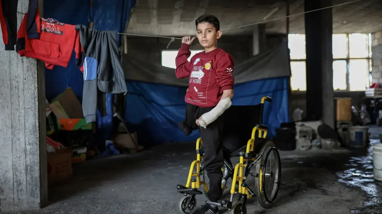 Mohammed al-Mubayyid, ni&ntilde;o de 12 a&ntilde;os, que perdi&oacute; una pierna en un ataque perpetrado por el ej&eacute;rcito terrorista israel&iacute; contra el barrio de al-Zaytoun, en la ciudad de Gaza, es fotografiado el 3 de diciembre de 2025. El ni&ntilde;o tambi&eacute;n sufri&oacute; fracturas graves y lesiones en la pierna y la mano izquierdas y est&aacute; de duelo por la p&eacute;rdida de su padre y de otros familiares - Omar Ashtawy / APA Images